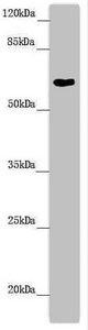 Western blot All lanes: FMO5 antibody at 6.04 ug/ml + Mouse liver tissue Secondary Goat polyclonal to rabbit IgG at 1/10000 dilution Predicted band size: 61, 33, 53 kDa Observed band size: 61 kDa