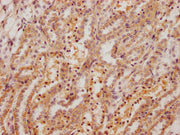 IHC image of CSB-PA008759HA01RA diluted at 1:200 and staining in paraffin-embedded rat kidney tissue performed on a Leica BondTM system. After dewaxing and hydration, antigen retrieval was mediated by high pressure in a citrate buffer (pH 6.0). Se...