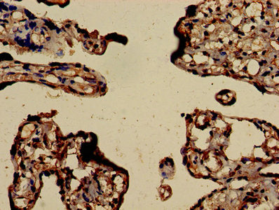 Immunohistochemistry of paraffin-embedded human placenta tissue using CSB-PA00875A0Rb at dilution of 1:100