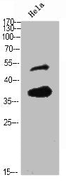 Western Blot analysis of HELA using Olfactory receptor 10H3/4 Polyclonal Antibody.