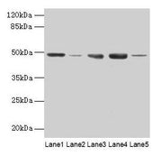 Western blot All lanes: FNTB antibody at 6µg/ml Lane 1: Hela whole cell lysate Lane 2: CEM whole cell lysate Lane 3: HepG2 whole cell lysate Lane 4: SH-SY5Y whole cell lysate Lane 5: A549 whole cell lysate Secondary Goat polyclonal to rabbit IgG a...