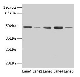 Western blot All lanes: FNTB antibody at 6µg/ml Lane 1: Hela whole cell lysate Lane 2: CEM whole cell lysate Lane 3: HepG2 whole cell lysate Lane 4: SH-SY5Y whole cell lysate Lane 5: A549 whole cell lysate Secondary Goat polyclonal to rabbit IgG a...