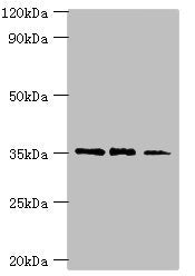 Western blot All lanes: FOSL2 antibody at 8ug/ml Lane 1: MCF-7 whole cell lysate Lane 2: Jurkat whole cell lysate Lane 3: PC-3 whole cell lysate Secondary Goat polyclonal to rabbit IgG at 1/10000 dilution Predicted band size: 36, 35, 32 kDa Observ...