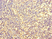 Immunohistochemistry of paraffin-embedded human tonsil tissue using CSB-PA008793HA01HU at dilution of 1:100
