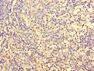Immunohistochemistry of paraffin-embedded human tonsil tissue using CSB-PA008793HA01HU at dilution of 1:100