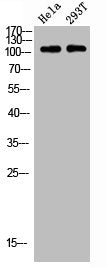 Western blot analysis of HELA 293T lysis using p52 S6 kinase antibody.