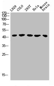 Western Blot analysis of L929 COLO 293T HELA MOUSE-brain cells using GHRH-R Polyclonal Antibody