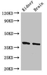 Western Blot Positive WB detected in: Mouse kidney tissue, Mouse brain tissue All lanes: FOXE1 antibody at 2.4ug/ml Secondary Goat polyclonal to rabbit IgG at 1/50000 dilution Predicted band size: 39 kDa Observed band size: 39 kDa
