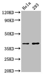 Western Blot Positive WB detected in: Hela whole cell lysate, 293 whole cell lysate All lanes: FOXH1 antibody at 2.7µg/ml Secondary Goat polyclonal to rabbit IgG at 1/50000 dilution Predicted band size: 40 kDa Observed band size: 40 kDa