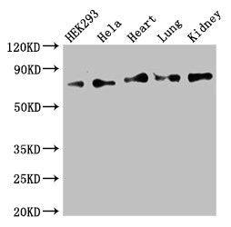 Western Blot Positive WB detected in: HEK293 whole cell lysate, Hela whole cell lysate, Mouse heart tissue, Mouse lung tissue, Mouse kidney tissue All lanes: FOXK1 antibody at 2.5ug/ml Secondary Goat polyclonal to rabbit IgG at 1/50000 dilution Pr...