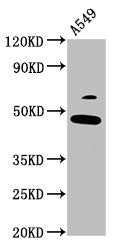 Western Blot Positive WB detected in: A549 whole cell lysate All lanes: FOXL2 antibody at 3.7µg/ml Secondary Goat polyclonal to rabbit IgG at 1/50000 dilution Predicted band size: 39 kDa Observed band size: 49 kDa