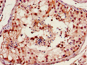 Immunohistochemistry of paraffin-embedded human testis tissue using CSB-PA008828HA01HU at dilution of 1:100