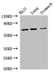 Western Blot Positive WB detected in: Raji whole cell lysate, Mouse lung tissue, Mouse stomach tissue All lanes: FOXN1 antibody at 2.7µg/ml Secondary Goat polyclonal to rabbit IgG at 1/50000 dilution Predicted band size: 69 kDa Observed band size:...