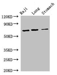 Western Blot Positive WB detected in: Raji whole cell lysate, Mouse lung tissue, Mouse stomach tissue All lanes: FOXN1 antibody at 2.7µg/ml Secondary Goat polyclonal to rabbit IgG at 1/50000 dilution Predicted band size: 69 kDa Observed band size:...