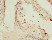 Immunohistochemistry of paraffin-embedded human testis tissue using CSB-PA008830ESR1HU at dilution of 1:100