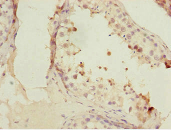 Immunohistochemistry of paraffin-embedded human testis tissue using CSB-PA008830ESR1HU at dilution of 1:100