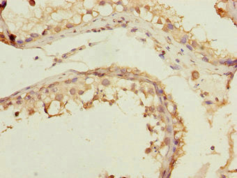 Immunohistochemistry of paraffin-embedded human testis tissue using CSB-PA008830ESR2HU at dilution of 1:100