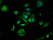 Immunofluorescence staining of MCF-7 cells with CSB-PA008840LA01HU at 1:133, counter-stained with DAPI. The cells were fixed in 4% formaldehyde, permeabilized using 0.2% Triton X-100 and blocked in 10% normal Goat Serum. The cells were then incuba...