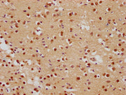 IHC image of CSB-PA008840OA01HU diluted at 1:500 and staining in paraffin-embedded human brain tissue performed on a Leica BondTM system. After dewaxing and hydration, antigen retrieval was mediated by high pressure in a citrate buffer (pH 6.0). S...