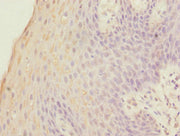 Immunohistochemistry of paraffin-embedded human tonsil tissue using CSB-PA008841EA01HU at dilution of 1:100