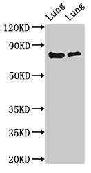 Western Blot Positive WB detected in: Rat lung tissue, Mouse lung tissue All lanes: FOXP1 antibody at 2ug/ml Secondary Goat polyclonal to rabbit IgG at 1/50000 dilution Predicted band size: 76, 55, 66, 75, 13, 67, 78 kDa Observed band size: 76 kDa