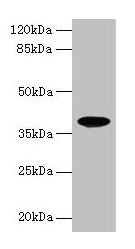 Western blot All lanes: FPR2 antibody at 8µg/ml + HL60 whole cell lysate Secondary Goat polyclonal to rabbit IgG at 1/10000 dilution Predicted band size: 39 kDa Observed band size: 39 kDa