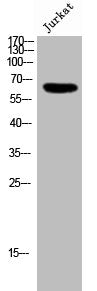 Western Blot analysis of Jurkat cells using GRK 6 Polyclonal Antibody