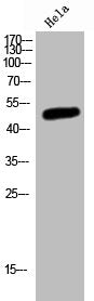 Western Blot analysis of HeLa cells using Mnk2 Polyclonal Antibody