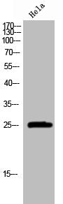 Western Blot analysis of Hela cells using GRB2 Polyclonal Antibody