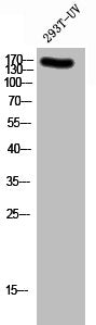 Western Blot analysis of 293T-UV cells using Phospho-NMDAε2 (Y1336) Polyclonal Antibody