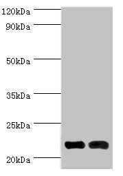 Western blot All lanes: Neuronal calcium sensor 1 antibody at 10ug/ml Lane 1: Hela whole cell lysate Lane 2: Rat kidney tissue Secondary Goat polyclonal to rabbit IgG at 1/10000 dilution Predicted band size: 22, 20 kDa Observed band size: 22 kDa