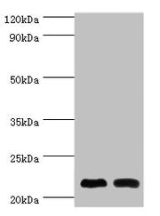 Western blot All lanes: Neuronal calcium sensor 1 antibody at 10ug/ml Lane 1: Hela whole cell lysate Lane 2: Rat kidney tissue Secondary Goat polyclonal to rabbit IgG at 1/10000 dilution Predicted band size: 22, 20 kDa Observed band size: 22 kDa