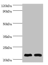 Western blot All lanes: Neuronal calcium sensor 1 antibody at 10ug/ml Lane 1: Hela whole cell lysate Lane 2: Rat kidney tissue Secondary Goat polyclonal to rabbit IgG at 1/10000 dilution Predicted band size: 22, 20 kDa Observed band size: 22 kDa