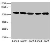 Western blot All lanes: FRKantibody at 3.13ug/ml Lane 1: Hela whole cell lysate Lane 2: 293T whole cell lysate Lane 3: K562 whole cell lysate Lane 4: MCF-7 whole cell lysate Lane 5: HepG2 whole cell lysate Secondary Goat polyclonal to rabbit IgG a...
