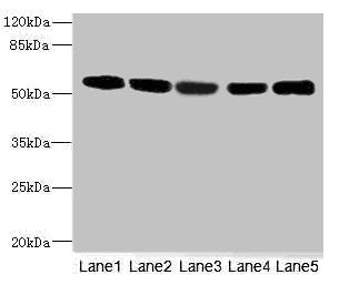 Western blot All lanes: FRKantibody at 3.13ug/ml Lane 1: Hela whole cell lysate Lane 2: 293T whole cell lysate Lane 3: K562 whole cell lysate Lane 4: MCF-7 whole cell lysate Lane 5: HepG2 whole cell lysate Secondary Goat polyclonal to rabbit IgG a...