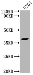 Western Blot Positive WB detected in: U251 whole cell lysate All lanes: FST antibody at 1:2000 Secondary Goat polyclonal to rabbit IgG at 1/50000 dilution Predicted band size: 39, 35 kDa Observed band size: 39 kDa
