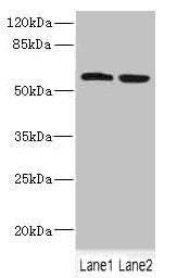 Western blot All lanes: FTCD antibody at 5.46ug/ml Lane 1: HepG2 whole cell lysate Lane 2: 293T whole cell lysate Secondary Goat polyclonal to rabbit IgG at 1/10000 dilution Predicted band size: 59, 62, 53, 17 kDa Observed band size: 59 kDa