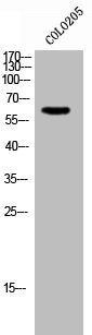 Western Blot analysis of COLO205 cells using TFIIH p44 Polyclonal Antibody