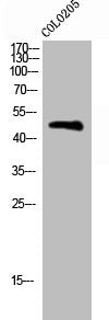 Western Blot analysis of COLO205 cells using Phospho-BLNK (Y96) Polyclonal Antibody
