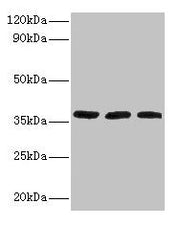 Western blot All lanes: FTSJ1 antibody at 2µg/ml Lane 1: HepG2 whole cell lysate Lane 2: Mouse brain tissue Lane 3: EC109 whole cell lysate Secondary Goat polyclonal to rabbit IgG at 1/15000 dilution Predicted band size: 37, 36 kDa Observed band s...