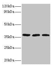 Western blot All lanes: FTSJ1 antibody at 2µg/ml Lane 1: HepG2 whole cell lysate Lane 2: Mouse brain tissue Lane 3: EC109 whole cell lysate Secondary Goat polyclonal to rabbit IgG at 1/15000 dilution Predicted band size: 37, 36 kDa Observed band s...