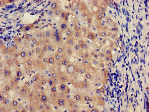 Immunohistochemistry of paraffin-embedded human liver tissue using CSB-PA009062LA01HU at dilution of 1:100