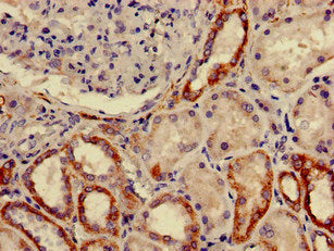 Immunohistochemistry of paraffin-embedded human kidney tissue using CSB-PA009068LA01HU at dilution of 1:100