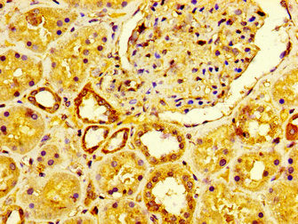 IHC image of CSB-PA009078LA01HU diluted at 1:600 and staining in paraffin-embedded human kidney tissue performed on a Leica BondTM system. After dewaxing and hydration, antigen retrieval was mediated by high pressure in a citrate buffer (pH 6.0)....