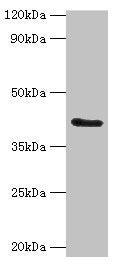 Western blot All lanes: FUT6 antibody at 4ug/ml + Hela whole cell lysate Secondary Goat polyclonal to rabbit IgG at 1/10000 dilution Predicted band size: 42, 43 kDa Observed band size: 42 kDa