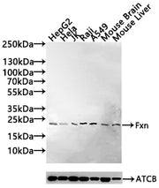 Western Blot Positive WB detected in: HepG2 whole cell lysate(30µg), Hela whole cell lysate(30µg), JK whole cell lysate(20µg), Raji whole cell lysate(30µg), A549 whole cell lysate(30µg), Mouse Brain tissue lysate(30µg),Mouse Liver tissue lysate(30...