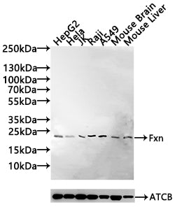 Western Blot Positive WB detected in: HepG2 whole cell lysate(30µg), Hela whole cell lysate(30µg), JK whole cell lysate(20µg), Raji whole cell lysate(30µg), A549 whole cell lysate(30µg), Mouse Brain tissue lysate(30µg),Mouse Liver tissue lysate(30...