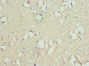 Immunohistochemistry of paraffin-embedded human brain tissue using CSB-PA009090ESR1HU at dilution of 1:100