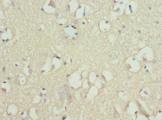 Immunohistochemistry of paraffin-embedded human brain tissue using CSB-PA009090ESR1HU at dilution of 1:100