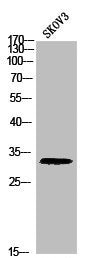 Western blot analysis of SKOV3 using p-Histone H1 (T17) antibody.